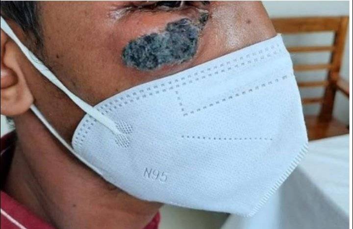 الفطر الأسود يغزو سوريا