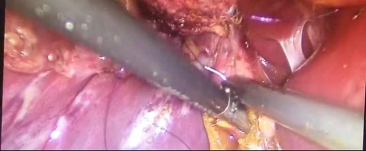 عمليات جراحية نوعية في مستشفى الملكة علياء العسكري…