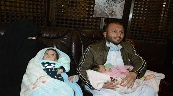 نجاح عملية فصل توأم يمني سيامي في الاردن