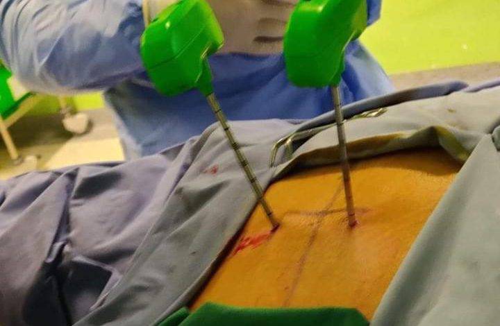 عمليات نوعية متقدمة بجراحة العمود الفقري بمستشفى الأميرة هيا