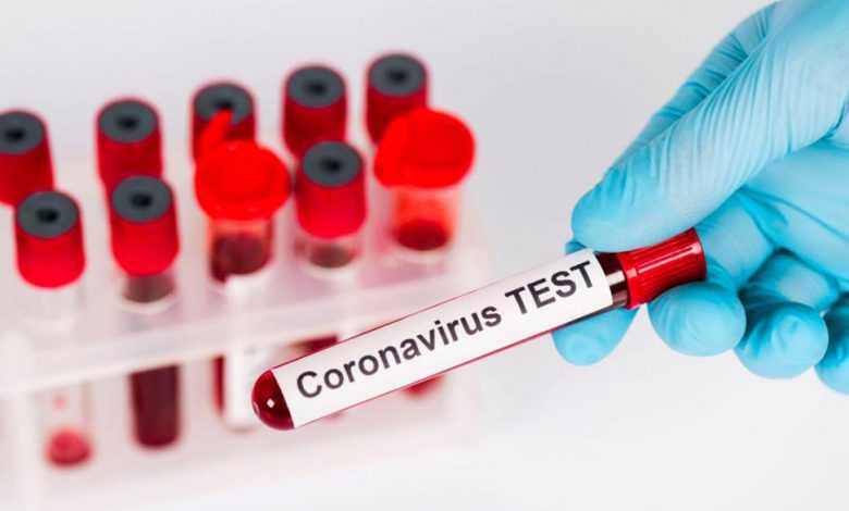 15 من إصابات كورونا هذا الأسبوع تعود لمتحور أوميكرون