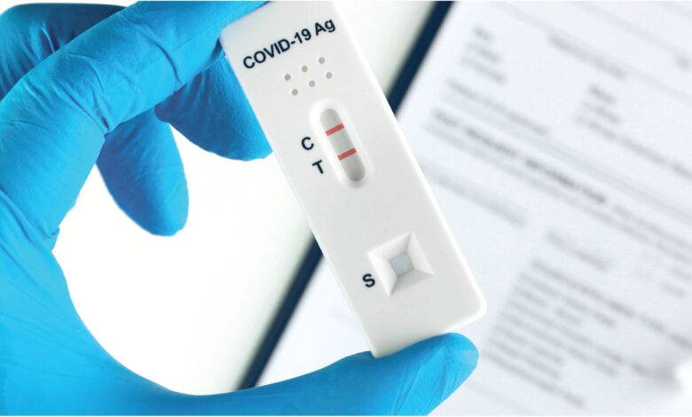 مهيدات يوضح حول قانونية بيع فحص كورونا السريع في الصيدليات