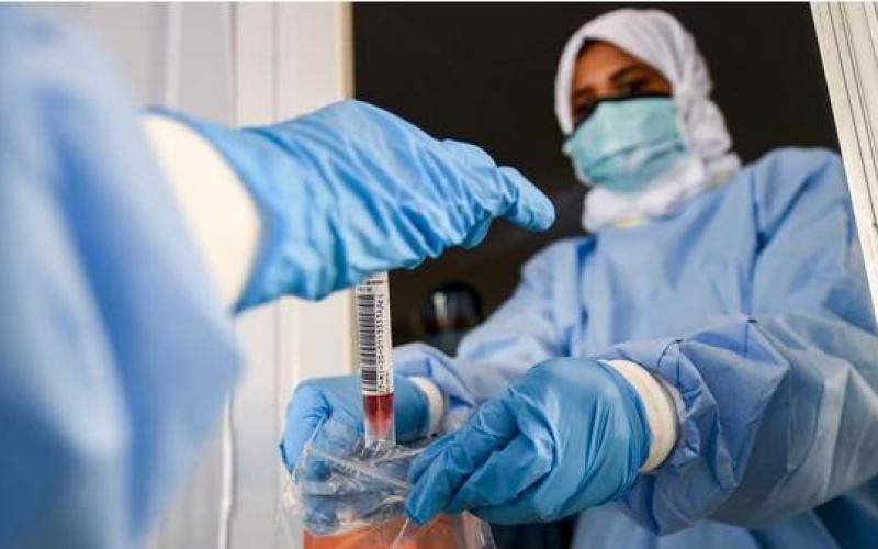 البدور: الجميع في الأردن سيصاب بـ  أوميكرون  وكل مكان أصبح بؤرة