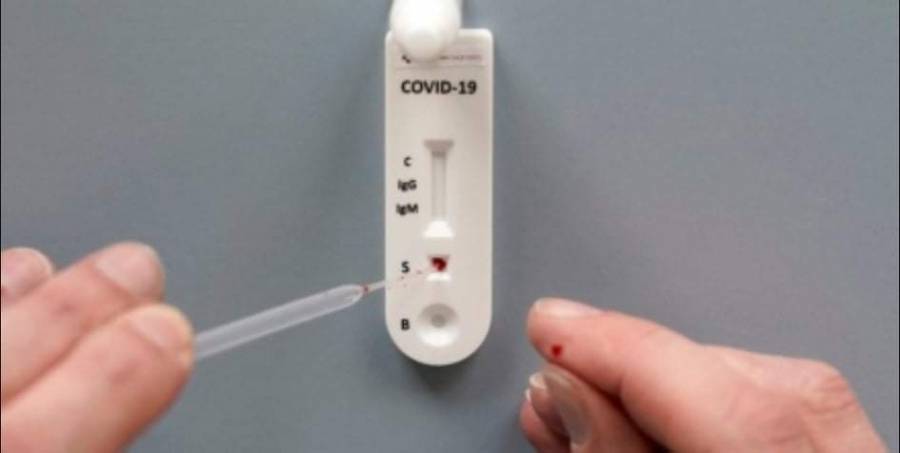 الغذاء والدواء: لا بُد من إيجاد شروط معينة لبيع فحص كورونا السريع في الصيدليات