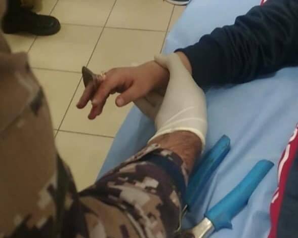 تحرير إصبع طفل علقت به قطعة حديد في الزرقاء