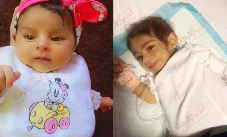 فزعة أردنية لإنقاذ حياة الطفلة أيلا