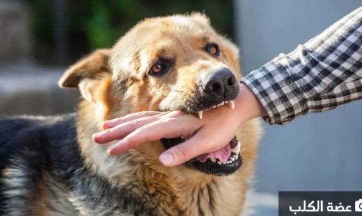 ماذا تفعل إذا تعرّضت لعضة الكلب أو حيوان آخر؟