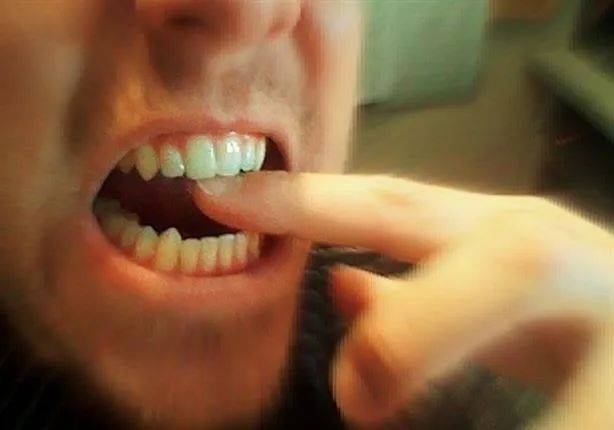 بسبب توبيخه.. عامل يقضم إصبع مديره ويقطعه