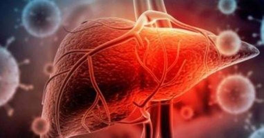 الأوبئة: الأردن لم يسجل أي إصابة بالتهاب الكبد الفيروسي الحاد