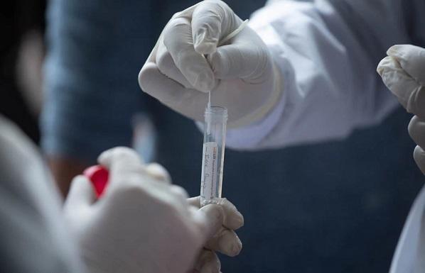 مراكز فحص كورونا طيلة الأسبوع