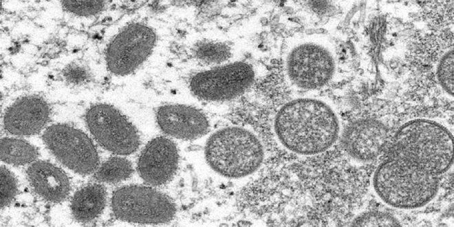 السويد وإيطاليا تسجلان أول إصابة بفيروس جدري القردة القاتل