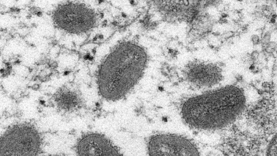 جدري القردة يتسلّل إلى أستراليا