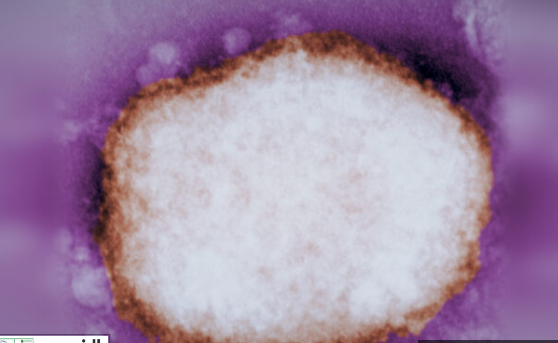 لا داعي للهلع.. هذا ما تحتاج لمعرفته عن جدري القرود