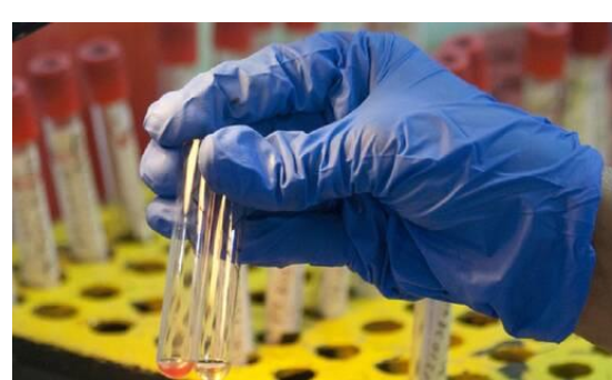 إسبانيا تدق ناقوس الخطر بسب مرض مجهول