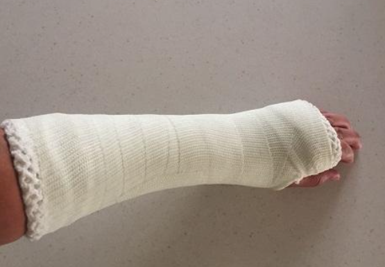 كيف يتم علاج كسر المعصم؟