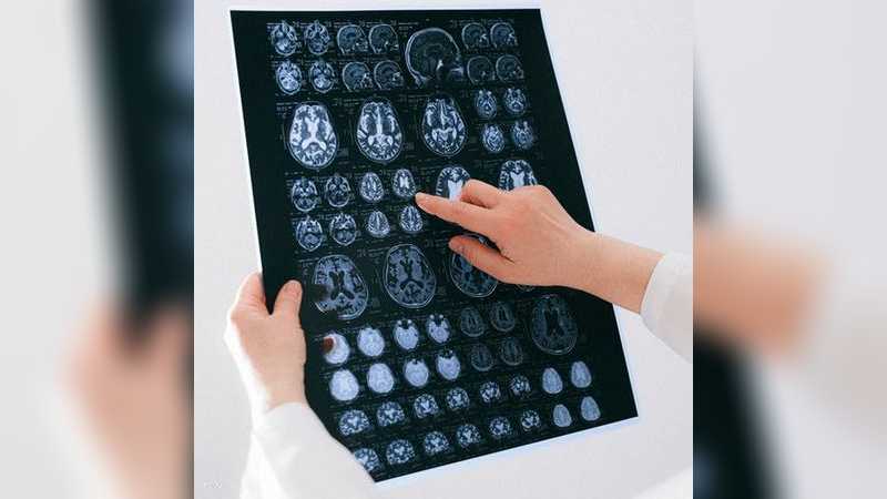 اضطراب نفسي يهدد بنية الدماغ.. دعوة للاستيقاظ