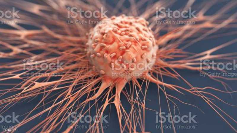 باحثون يصممون إنزيما يقتل نوعا صعبا من سرطان الثدي