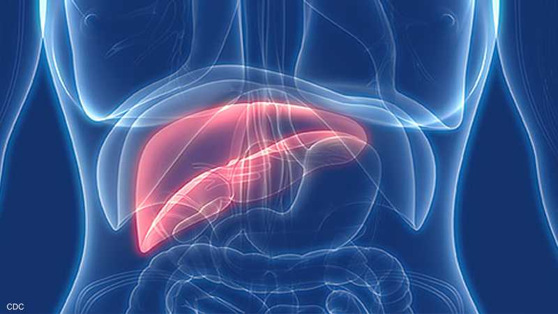 سرطان الكبد.. السكر عامل خطر محتمل