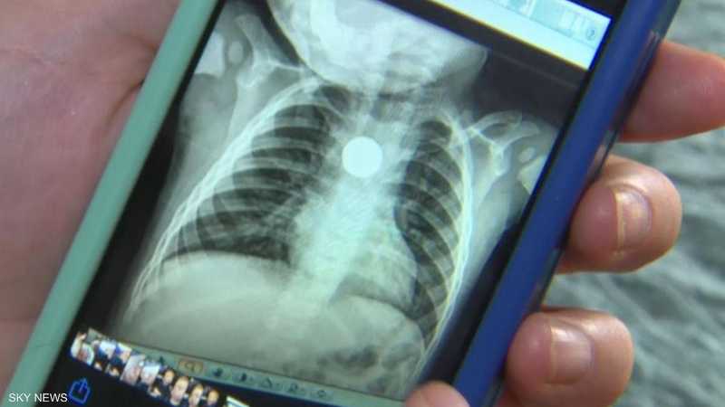 تحذير عاجل من خطر البطاريات على الأطفال