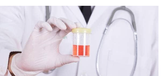 التهابات المسالك البولية.. تعرف على الأعراض والأسباب