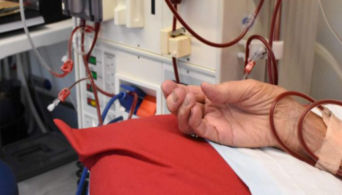 الاستماتة الحديدية تعالج نوع نادر من سرطان الكلى.. فما هي؟