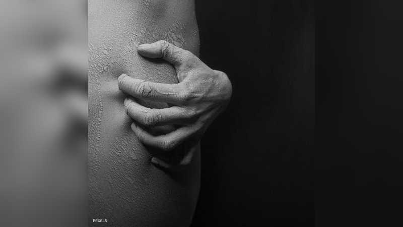 اكتشاف جديد يقلل من أكثر أعراض الأكزيما إزعاجا