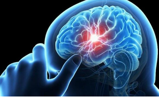 دواء لجلطات القلب يعالج سكتات الدماغ