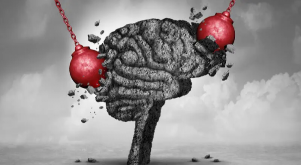 8مفاهيم خاطئة عن الصداع النصفي