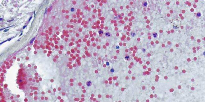 متحور أوميكرون الجديد قد يسبب ثاني أكبر موجة من كوفيد