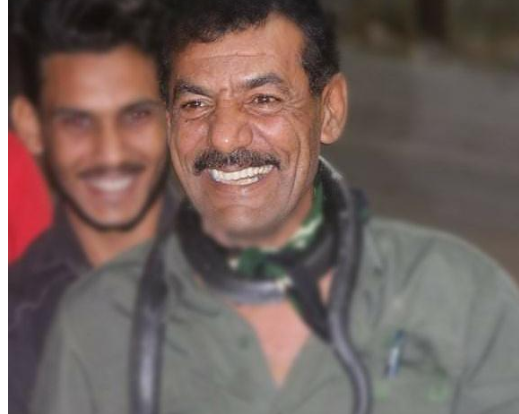 تعرض خبير أفاعي اردني للدغة أفعى