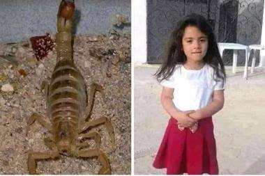 وفاة الطفلة العراقية شهد بلدغة عقرب تثير مواقع التواصل