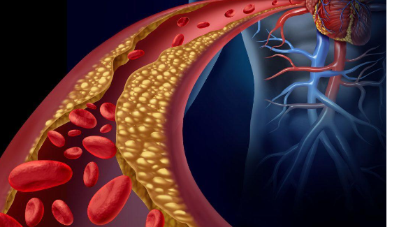 أطعمة تحارب ارتفاع مستويات الكوليسترول الضارة بالدم