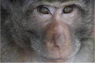 الولايات المتحدة تسجل أول وفاة بجدري القردة