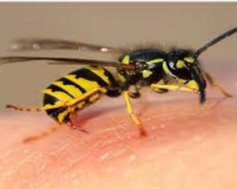 ابو رمان : إدخال طفل العناية الحثيثة نتيجة تعرضه للسعات دبور