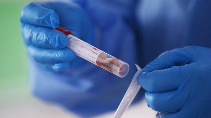 بالاسماء ...مراكز فحص كورونا العاملة الجمعة