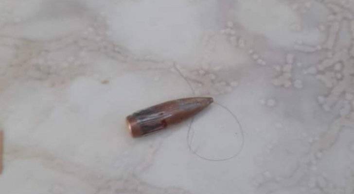 عاجل ..إصابة سيدة برصاصة طائشة في مأدبا
