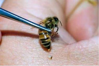 وزارة الصحة تحذر من العلاج بالديدان وسم النحل