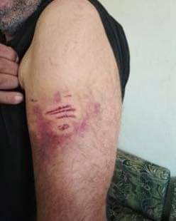 عجلون : كلب ضال يهاجم خمسينيا في بلدة سامتا وضح النهار _صور