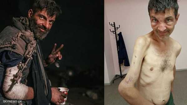 هيكل عظمي.. أسير أوكراني محرر يكشف أهوال السجون الروسية