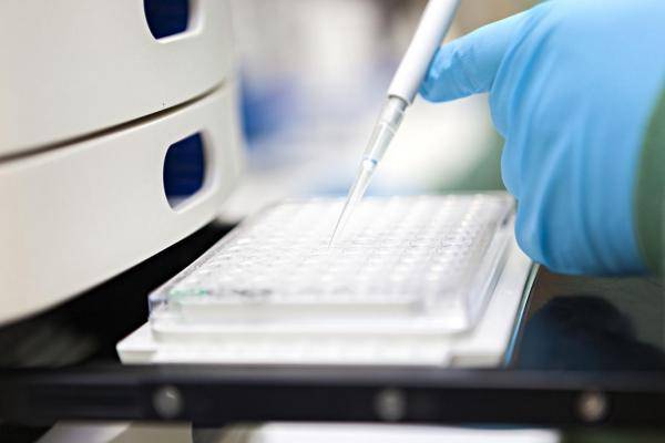 الصحة: لا اصابات بالكوليرا وفحوص سريعة تصل الأردن الأسبوع القادم