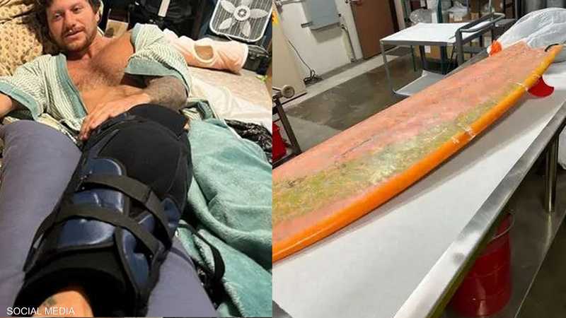 راكب أمواج يروي كيف نجا من فكي قرش عملاق