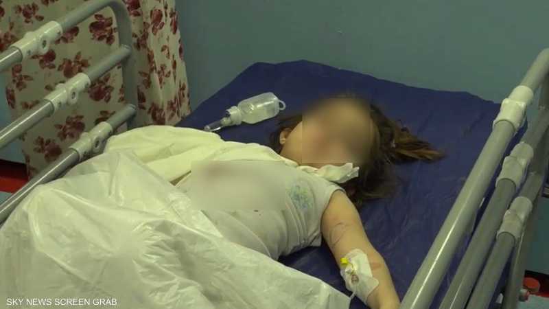 العراق.. دب ينهش ذراع طفلة في حديقة حيوانات