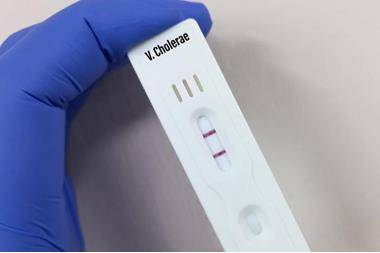 البلبيسي يوضح حول تسجيل 3 إصابات كوليرا في الأردن