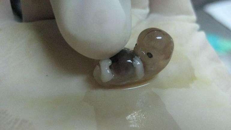 العثور على جثة جنين داخل مرطبان بجانب حاوية قمامة في عمان