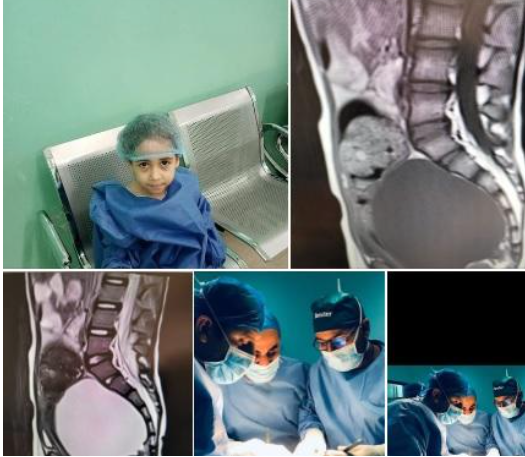 طبيب أردني ينهي معاناة طفلة سورية في البشير