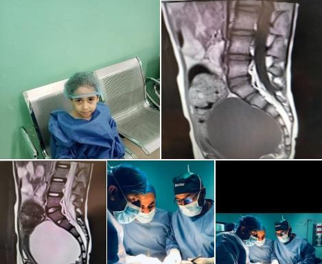 الطبيب الرحامنة ينهي معاناة طفلة سورية في البشير