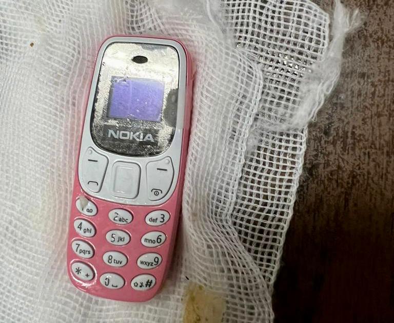 فريق طبى يستخرج هاتفا محمولا من معدة شاب بمستشفى الطوارئ الجامعي بطنطا.. صور