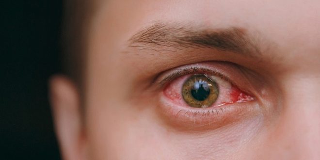 ما أضرار داء السكري على العين؟