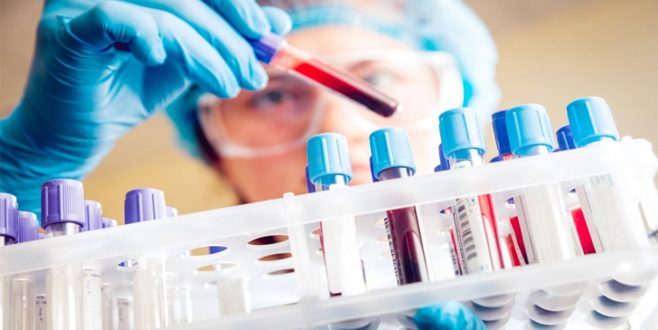 باحثون أمريكيون يطورون علاجاً جديداً لمرض سرطان الدم