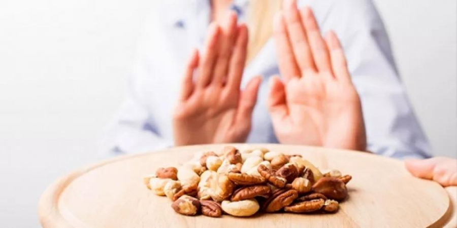 ارتفاع بحالات حساسية الأطعمة بالاردن